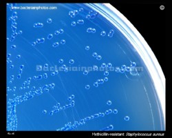 MRSA bacteria on ORSAB
